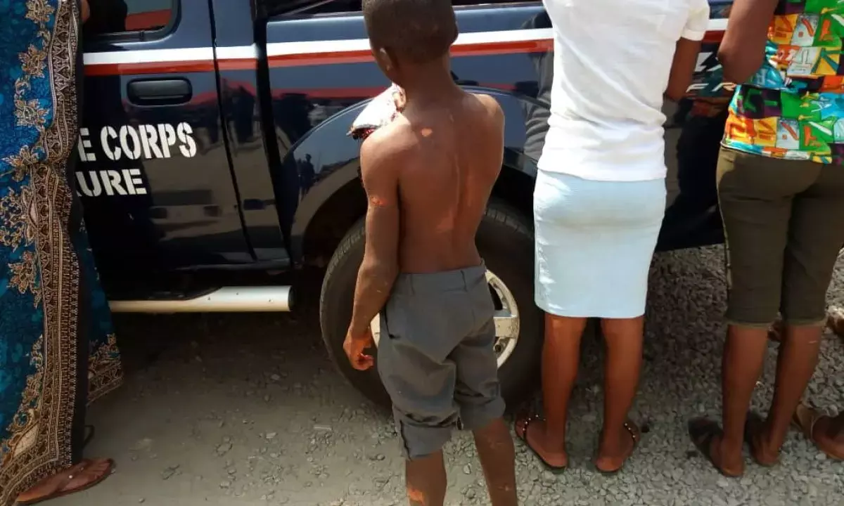 Woman bathes child with boiled water, Kaduna govt. intervenes