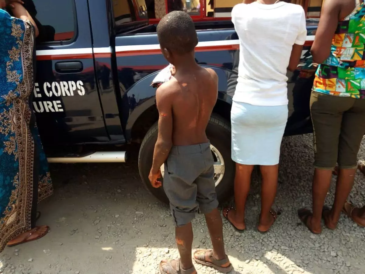 Woman bathes child with boiled water, Kaduna govt. intervenes Woman bathes child with boiled water, Kaduna govt. intervenes