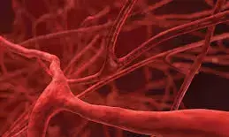 What clean blood vessels -  Dr Uyigue