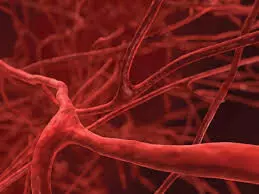 What clean blood vessels -  Dr Uyigue
