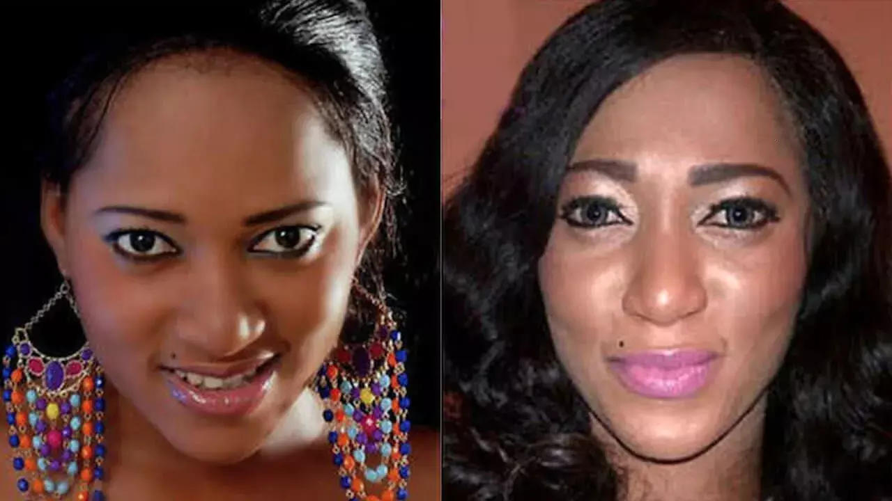 Dangers of skin bleaching trend in Nigeria