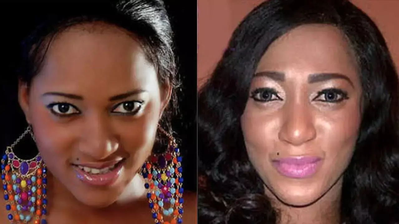 Dangers of skin bleaching trend in Nigeria