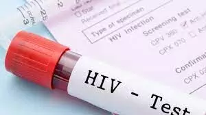 UNAIDS reveals existence of  dangerous HIV variant