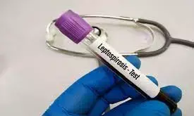 Fiji records 29 people die of leptospirosis