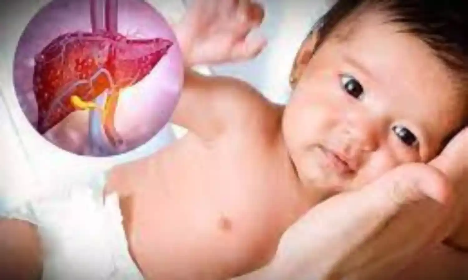 Cause of child hepatitis outbreak, mysterious says EU health agency