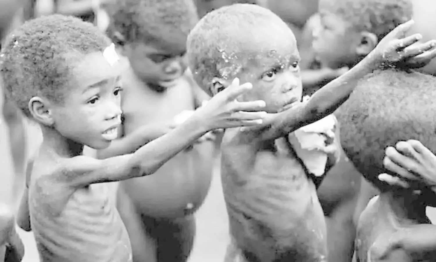 Surpressing malnutrition, the silent child killer