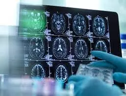 Scientists identify location of neurons causing chronic pain