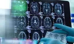 Scientists identify location of neurons causing chronic pain