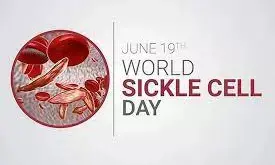 World Sickle Cell Day: Yobe offers free clinical care to sickle cell carriers