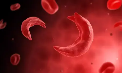 How I survived sickle cell anaemia crisis – Consultant haematologist