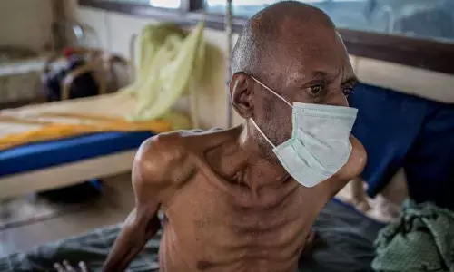 Examining roles of men in heightening TB cases