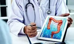 Group advocates liver transplant services in Nigeria