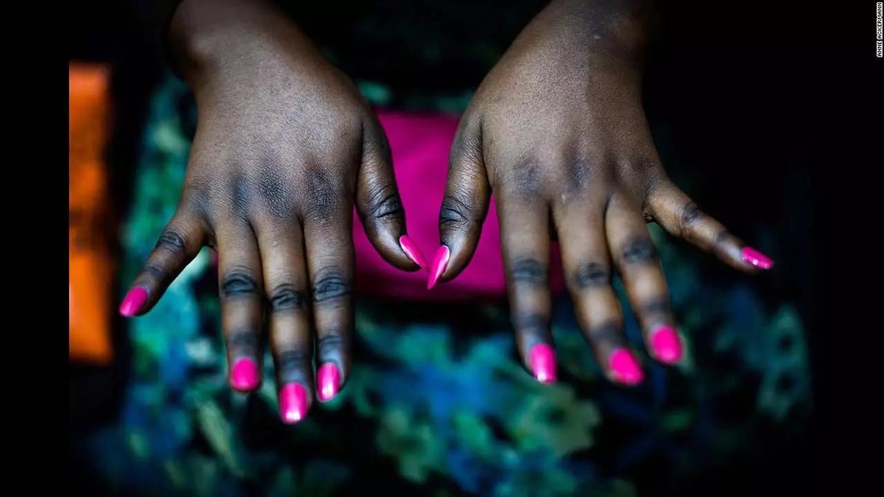 Skin lightening/ whitening: Before You Bleach That Skin