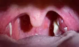 Dentist warns against sharing utensils with children Dentist warns against sharing utensils with children