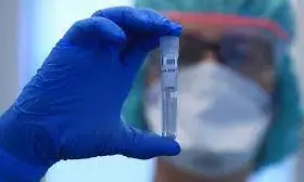 COVID- 19: German expert questions relevance of testing Chinese travellers