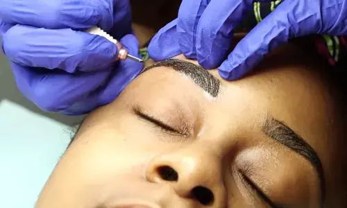 Tattooing of eyebrows can cause infections, keloid, toxicity - Dermatologist