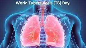World TB Day: Ogun urges residents to utilize free TB tests