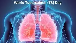 World TB Day: Ogun urges residents to utilize free TB tests