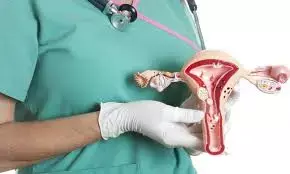 Cervical cancer kills 28 Nigerian women everyday – Gynaecologist
