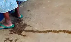 Agony of 46-year-old woman living with irreversible VVF , RVF