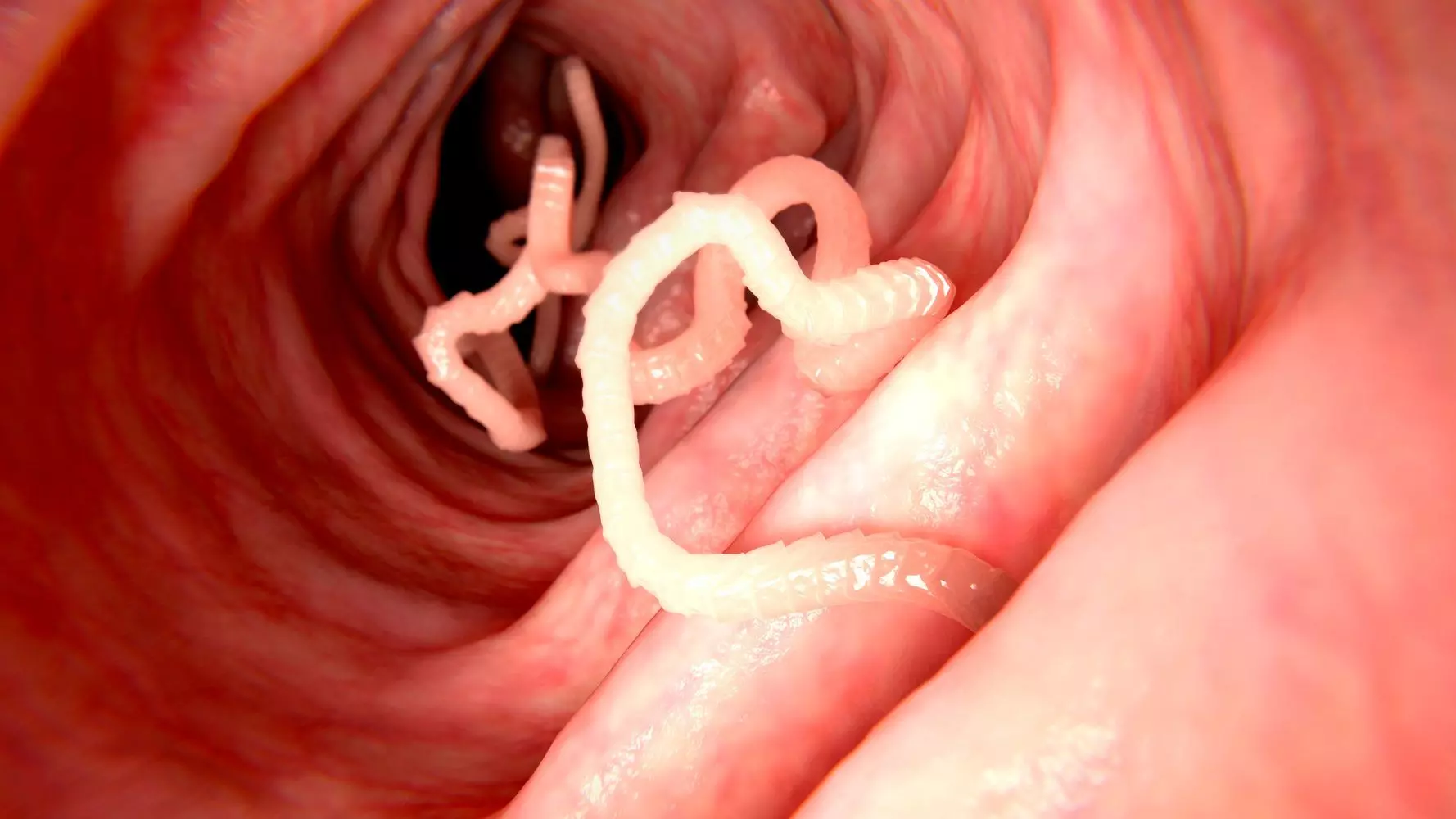 World-first discovery: Live worm found in woman’s brain
