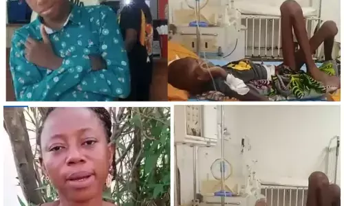 Lagos State Govt takes over medical care of 13-year-old boy with ”missing intestine”