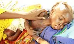 Malnutrition: 10 babies died in FCT IDPs Camp – Official