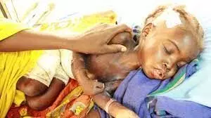 Malnutrition: 10 babies died in FCT IDPs Camp – Official