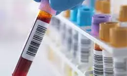 FG warns against use of rapid test-kits for blood screening