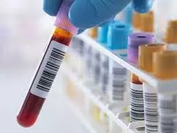 FG warns against use of rapid test-kits for blood screening