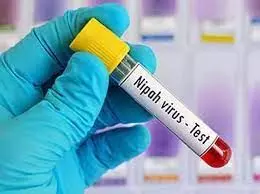 Scientists test world’s first Nipah virus vaccine