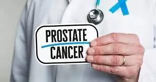 Prostate cancer: Scientist recommends yearly screening for men above 40