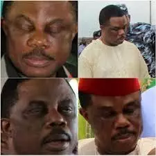 Uzodike says EFCC’s arraignment of Obiano sad