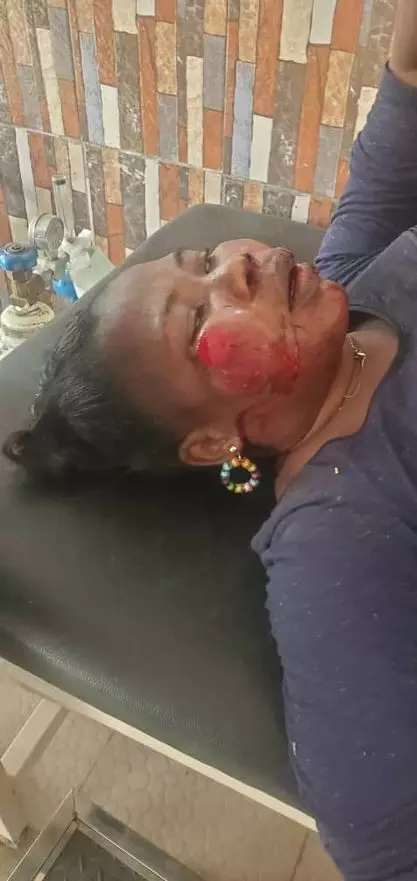 Police arrest man for allegedly inflicting injuries on ex-wife Police arrest man for allegedly inflicting injuries on ex-wife