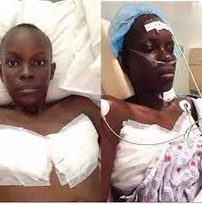 Cancer rates to increase to 77 % by 2050, says UN