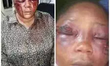 FG directs medical practitioners, facilities to treat gunshot, “one-chance” victims without police report