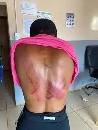 Police arrest school principal for allegedly flogging, injuring female student