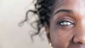 Cataract: Project manager says 70% of patients in rural areas