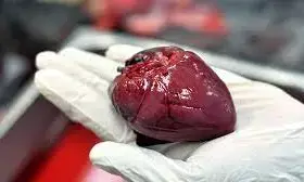 MD Alliance Hospital, 3 others docked for alleged organ harvesting MD Alliance Hospital, 3 others docked for alleged organ harvesting