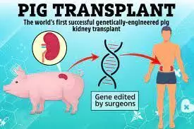 Pig kidney successfully transplanted into human for the first time