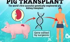 Pig kidney successfully transplanted into human for the first time