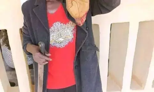 Centre wants stiffer sanction for Policeman who cut off wife’s hand