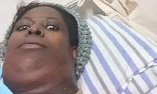 Nigeria still far behind in cancer treatment – NCS