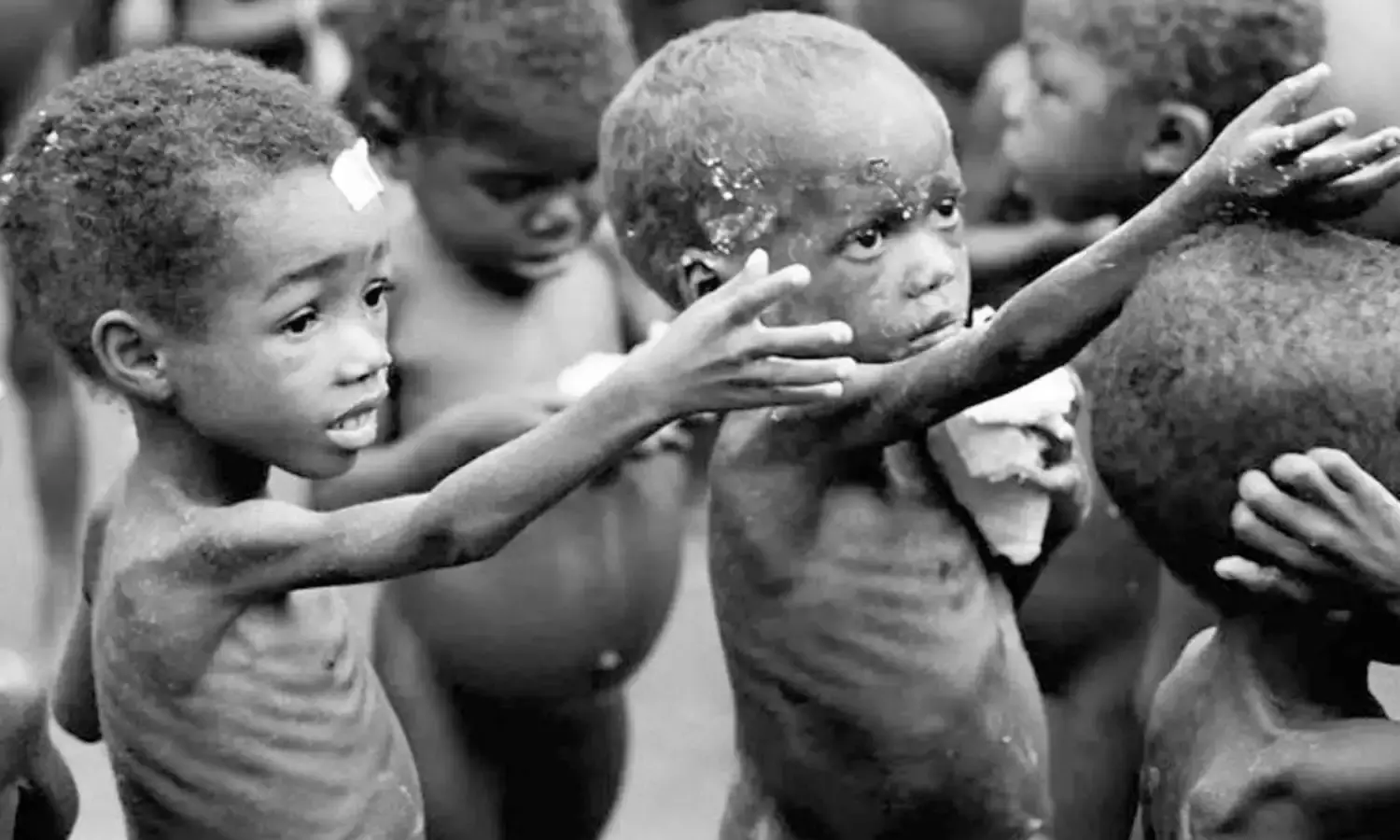 Experts fear fuel hike will lead to malnutrition