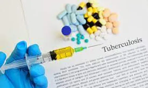 Tuberculosis: Public health expert urges early diagnosis, treatment of resistant cough