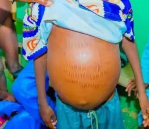 Sokoto Govt. warns against unsafe metal poisoning treatments