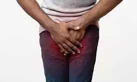 Urologist warns no amount of sex, special diet can prevent prostate cancer