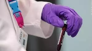 U.S. Anti-doping Chief Wants More Transparency in Testing