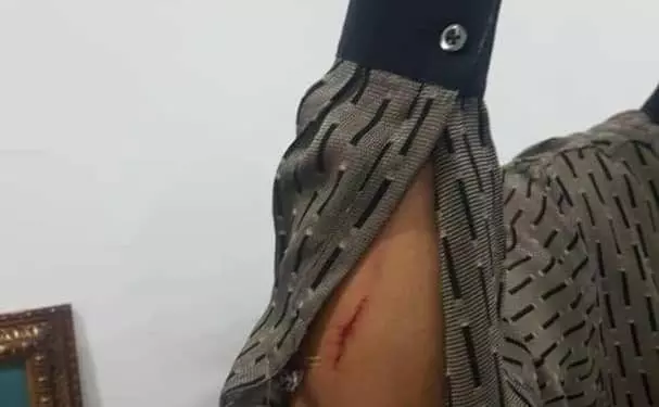 Former Rivers State Governor injured as Party faithfuls Clash +Photos, Video.