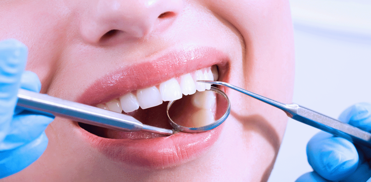 Expert calls for proper mouth care to avoid diseases